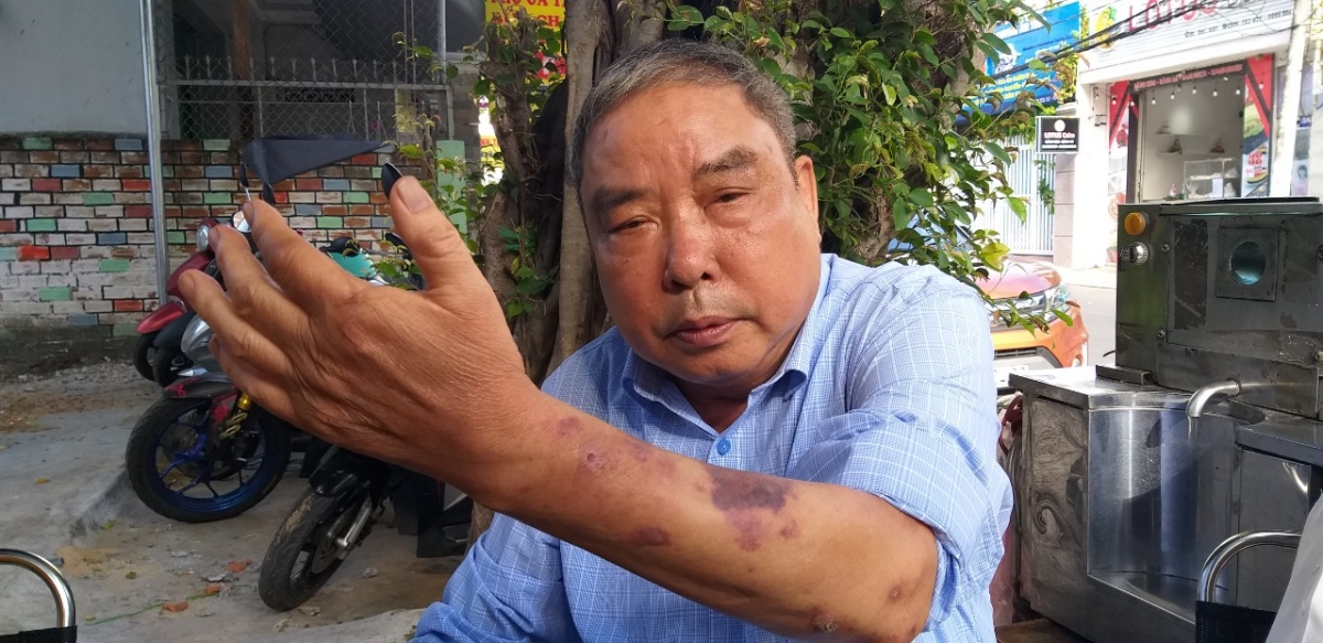 Người lính ở lại sau 1975