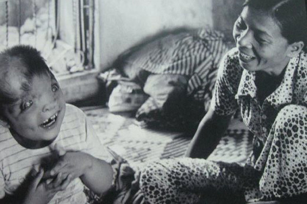 Đường dài chông gai của việc khắc phục hậu quả dioxin