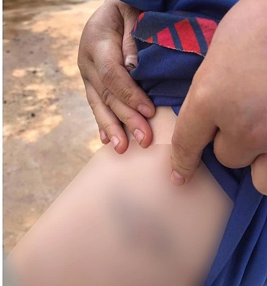 Cháu bé 9 tuổi bị bà và cha đánh đập dã man