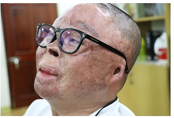 Người sống sót duy nhất vụ rơi máy bay Mi 171 đau đáu tâm niệm với đồng đội hy sinh