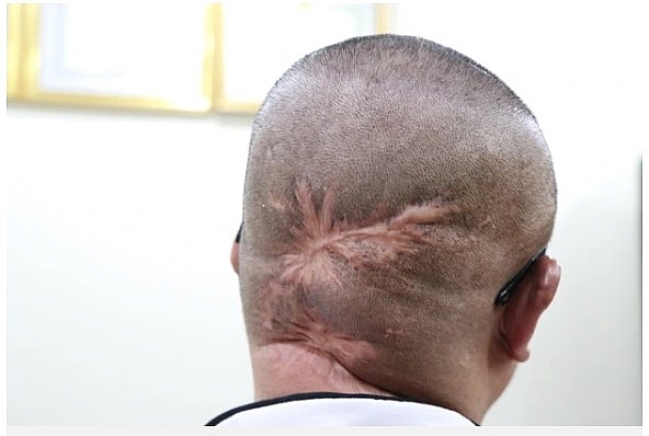 Người sống sót duy nhất vụ rơi máy bay Mi 171 đau đáu tâm niệm với đồng đội hy sinh