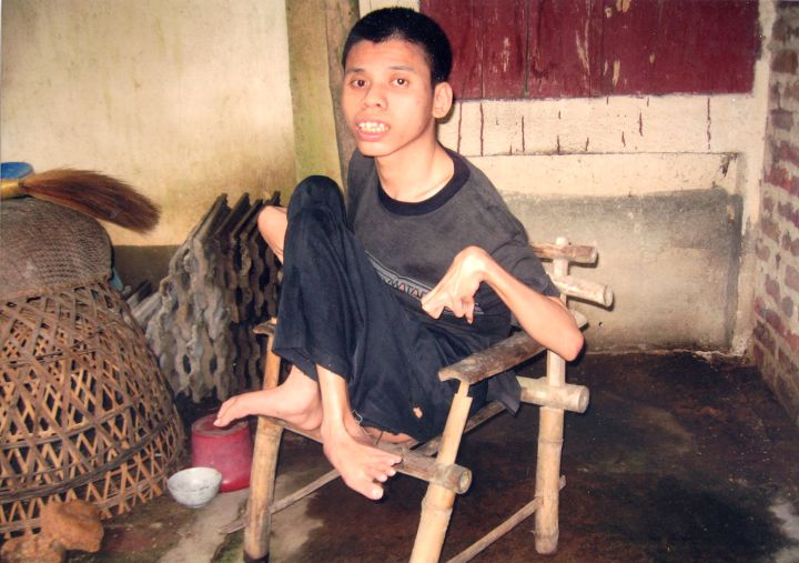 Bài dự thi: Để NNCĐDC không bị thiệt thòi