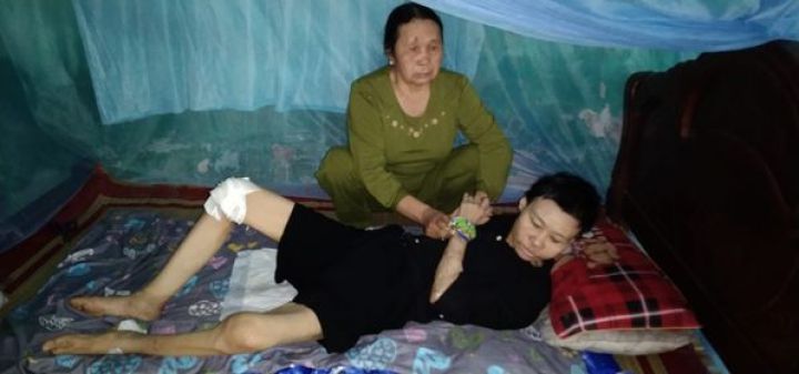Nạn nhân chất độc da cam Hà Thị Tuyết Mai rất cần được giúp đỡ