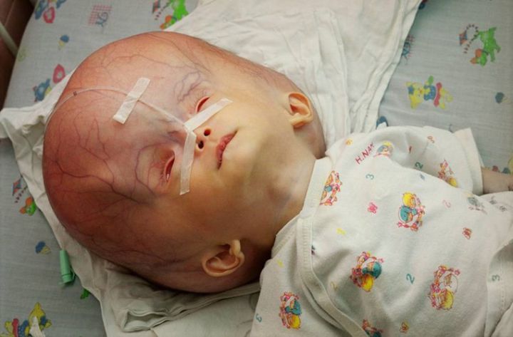 Scary photos of the sequelae of Vietnam War