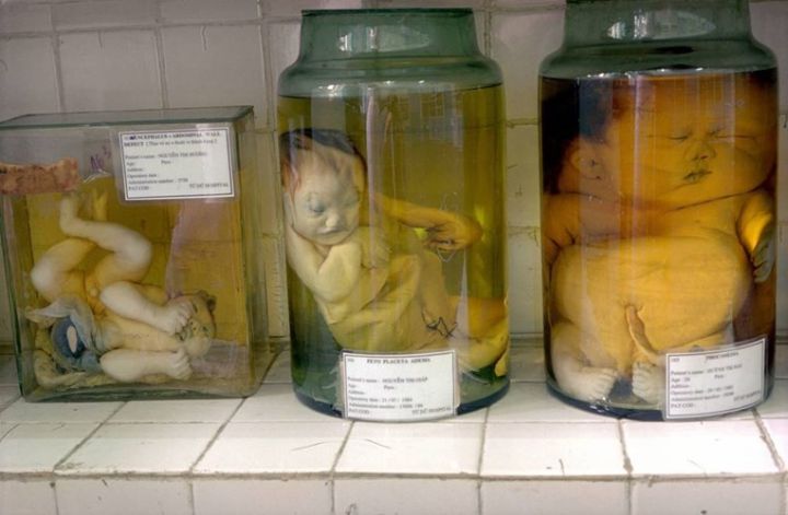 Heartbreaking pain of a father with four Agent Orange – affected children