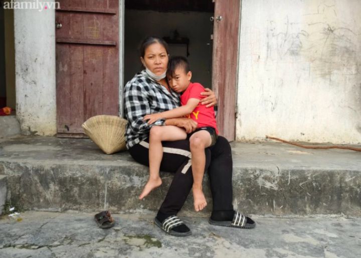 Cậu bé 7 tuổi bị cha chối bỏ vì sinh ra không có hậu môn, thiểu năng trí tuệ