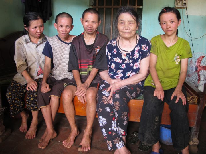 Một gia đình NNCĐDC rất cần sự giúp đỡ