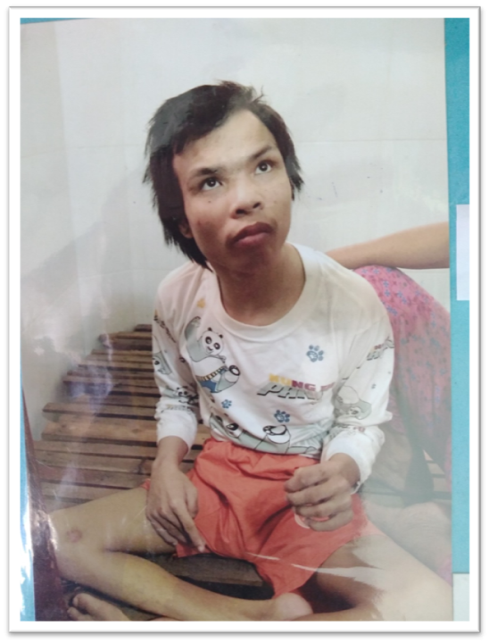 Má con NNCĐDC Vũ Trường Dương rất cần sự giúp đỡ!