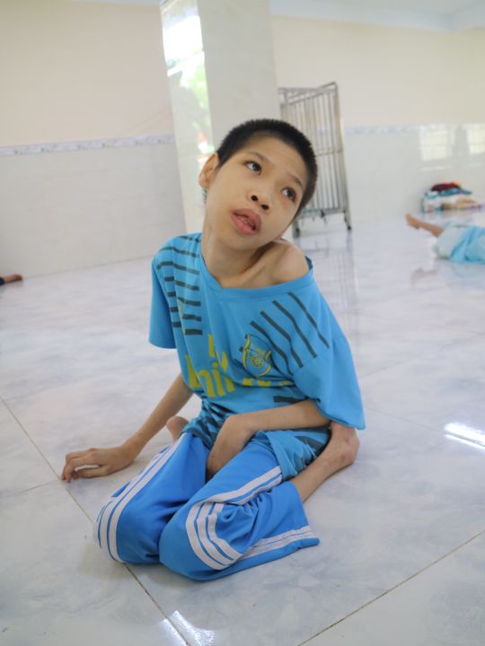 Album ảnh: Nạn nhân chất độc da cam/dioxin tại Trung tâm Bảo trợ xã hội thành phố Cần Thơ