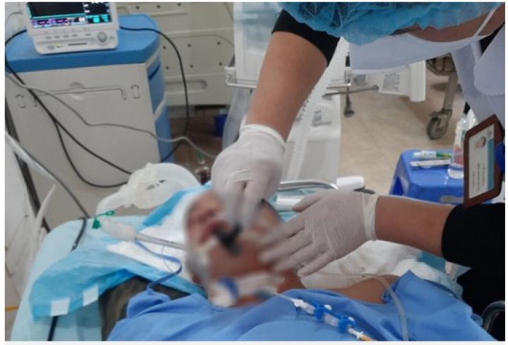 Chủ quan với vết thương nhỏ, nam thanh niên mắc uốn ván nguy kịch