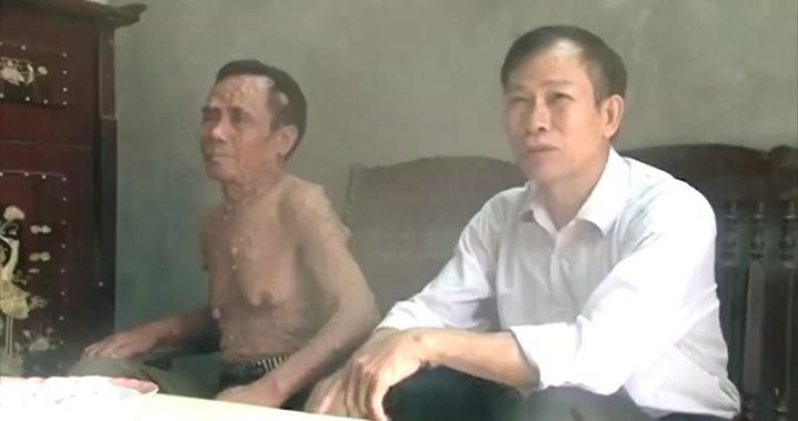 Mê Linh chung tay xoa dịu nỗi đau da cam