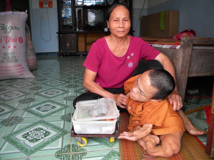 Nghị lực của những người Mẹ có con bị nhiễm chất độc da cam/dioxin